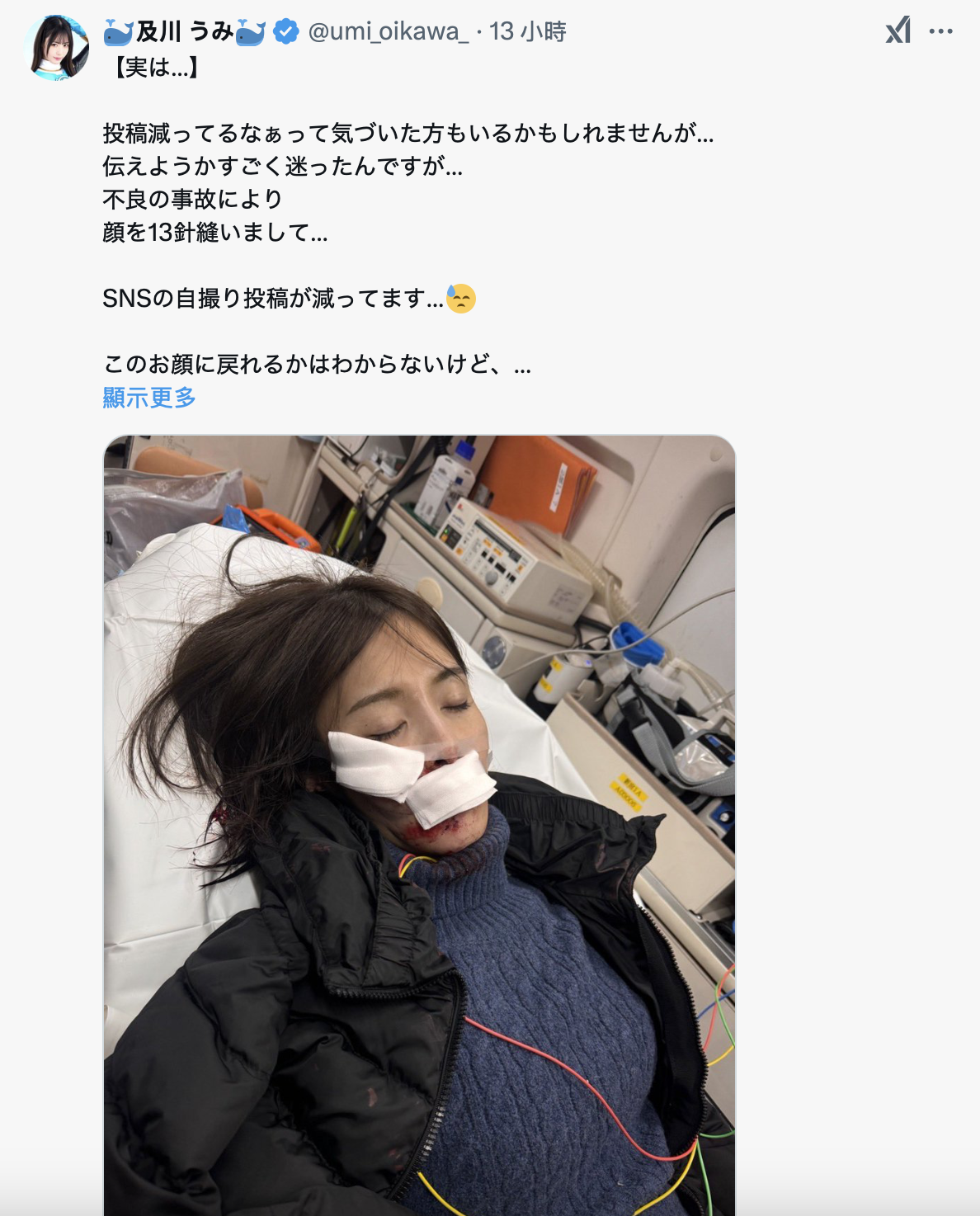 社群发文变少⋯原来及川うみ(及川海)出大事了！-图片2